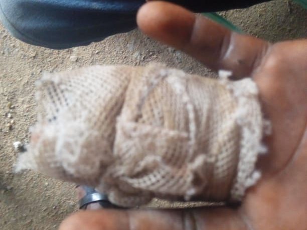 Assin Fosu: Businessman slashes 10-year-old boy’s fingers for stealing his scrap